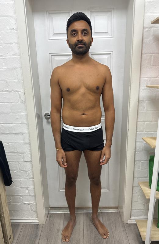 Amit before transformation